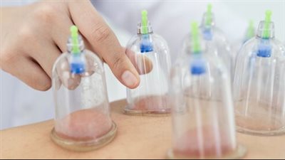 فوائد الحجامة الصحية وأهميتها في علاج العديد من الأمراض