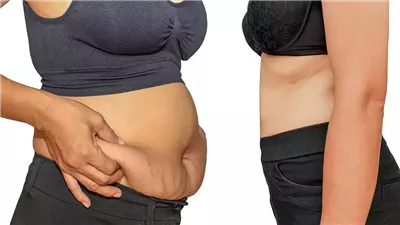 كيفية التخلص من الكرش بسرعة للرجال والنساء بخطوات بسيطة