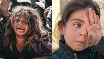 جوعان وبدي آكل.. أطفال غزة يواجهون المجاعة والموت البطيء