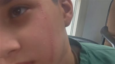 السجن سنة بدلًا من سنتين.. تخفيف عقوبة والد الطالب المتهم بالتعدي على زميله في البدرشين