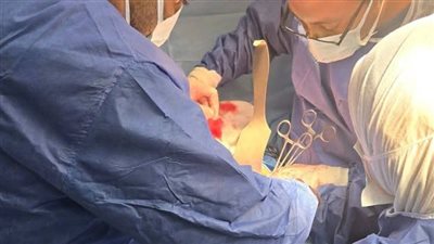 بعد إجراء 5 جراحات دقيقة.. إنقاذ حياة شاب تعرض لحادث مروع في المنوفية 