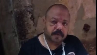 إصابة موظف بعد الاعتداء عليه وسرقة متعلقاته في الجيزة