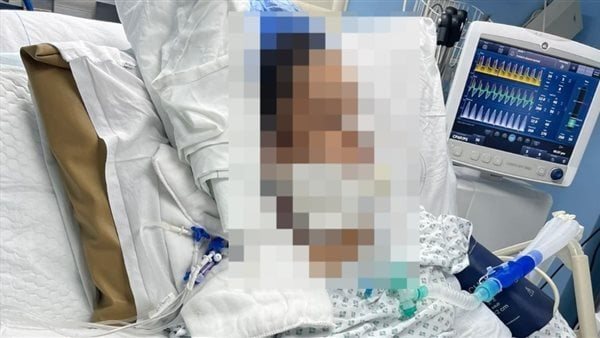 نورزاد ضحية الإهمال