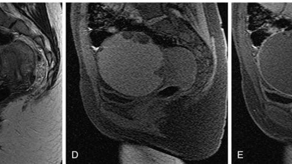 جانب من الجزاحة