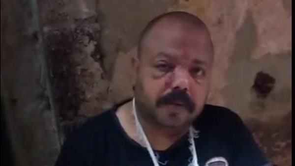 إصابة موظف بعد الاعتداء