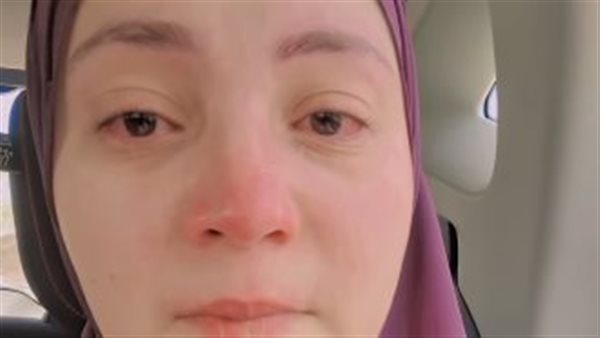 والدة الطفل علي المصاب