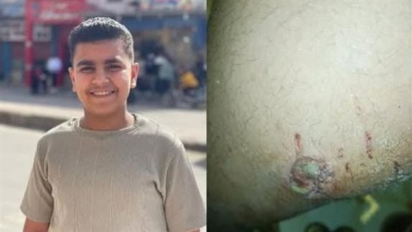 الصغير المصاب 