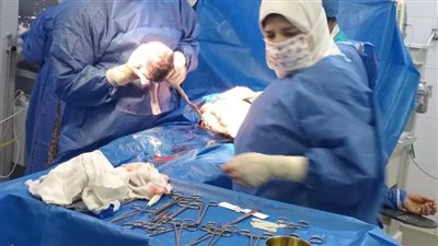 سيدة تضع 4 توائم في عملية حرجة ناجحة بمستشفى أشمون بالمنوفية 