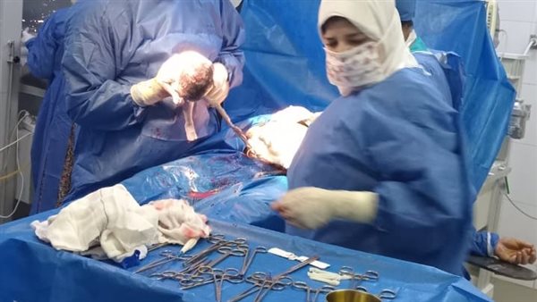 عملية الولادة بالمنوفية