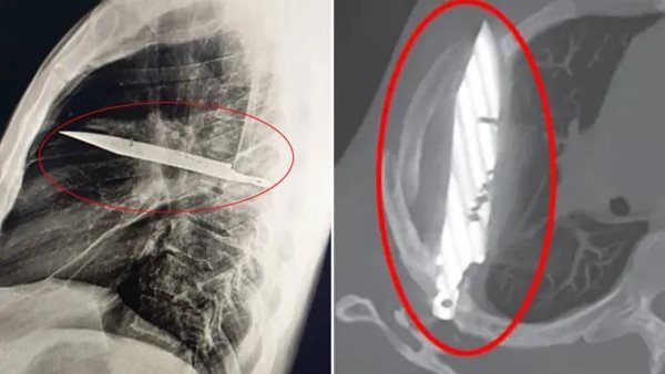 الأشعة المقطعية للرجل