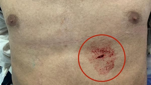 فريق طبي بمستشفى