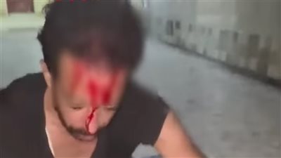 الأجهزة الأمنية تفحص تعدي صبية على شاب بسلاح أبيض بسبب مضايقة فتاة بالإسكندرية