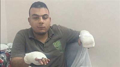 قطعولي إيديا.. شاب يكشف تفاصيل إصابته على يد بلطجية في الوراق بعد إطلاق نار