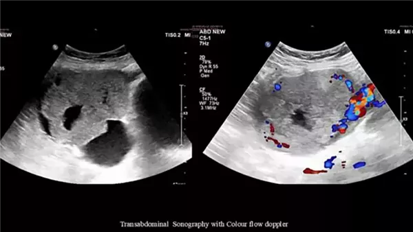صورة تعبيرية 