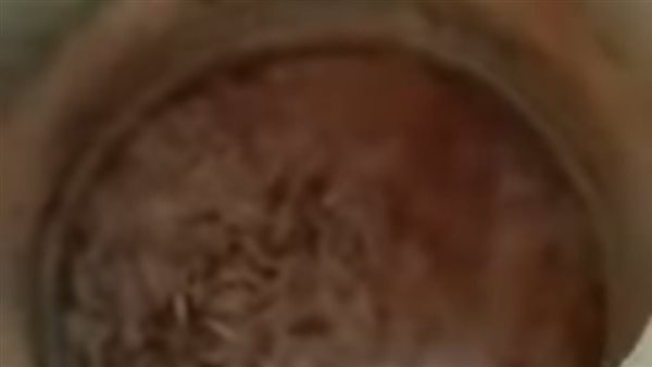 جانب من الحملة 