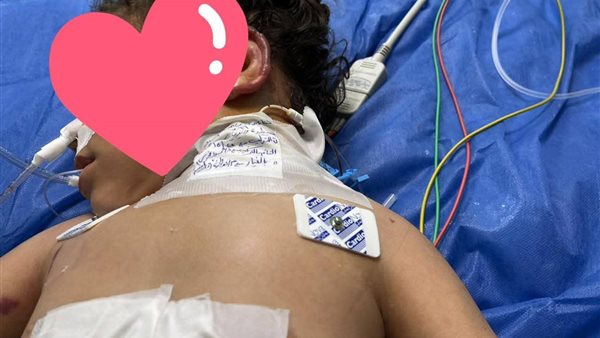 إنقاذ طفلة بعد سقوطها