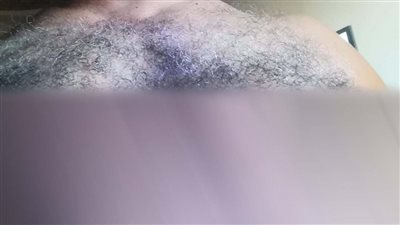 محامٍ يحرر محضرًا ضد طبيب جلدية شهير بالغربية بتهمة التسبب في حروق بالصدر