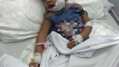 صغيرة تواجه الموت بعد هجوم كلب ضال| تحتاج 400 ألف جنيه لإجراء عملية.. ووالدها: رهنت سيارتي لتغطية نفقات العلاج