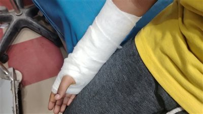 عضه وضربه.. ولي أمر يحرر محضرًا ضد شاب من ذوي الهمم تعدى على نجله بالمنوفية