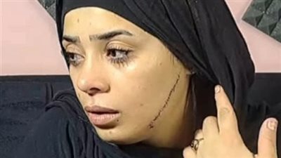 محاكمة المتهمة بتشويه خطيبة طليقها بمصر القديمة