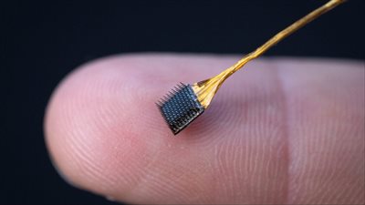 شريحة الفضائح.. باحثون يطورون جهازا يتم وضعه بالدماغ لترجمة أفكار مرضى الشلل الدماغي