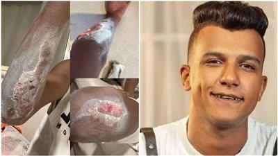 إصابة عصام صاصا بجروح عميقة في يده