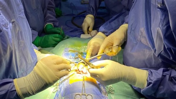 صورة من العملية الجراحية