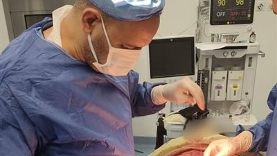 للمرة الأولى.. استئصال ورم ليفي نادر منغرس بالأمعاء الدقيقة بمستشفى طهطا العام في سوهاج