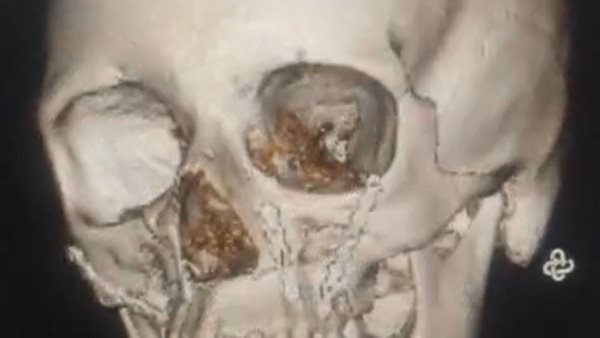 نموذج تمثيلي للجراحة