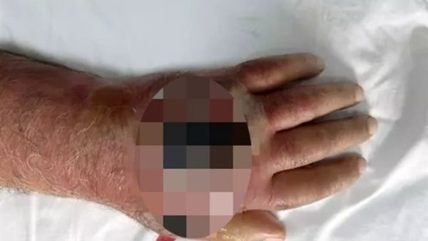 يد الرجل المسن