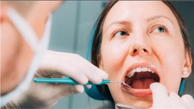 تعرف على أعراض وطرق علاج حصوات الغدد اللعابية