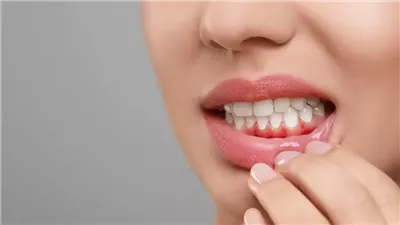 مشكلة اللثة قد تهدد صحتك العامة.. وخبراء ينصحون بالخيط المائي