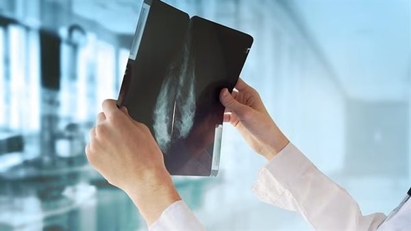 فحص القلب ـ تعبيرية