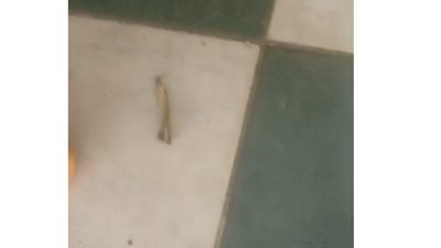 مريض يشكو من وجود عظمة دجاجة على الأرض ومخلفات داخل غرفة الحجز بمعهد الكلى القومي