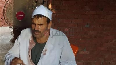 بسبب كوب زجاجي.. اعتداء وسحل سيدة وإصابة والدها بـ12 غرزة بالشرقية