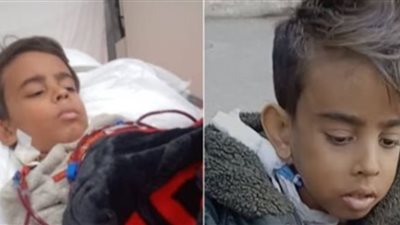 أم فلسطينية ترافق نجلها المريض بالفشل الكلوي بمستشفى شبين الكوم وتوجه نداء استغاثة لمساعدتها