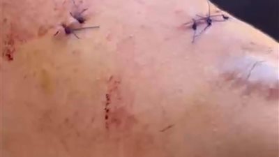 اعتداء 5 شباب على طالب ثانوية أمام مدرسته بالدقهلية 