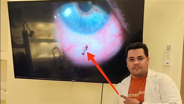 طبيب أقصري ينقذ مريضة