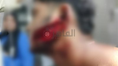 شوهوا وشه.. القبض على سائق وشقيقه اعتديا على شاب من ذوي الهمم ووالده بالمنوفية