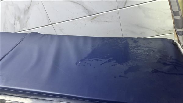 صورة من سرير الفحص