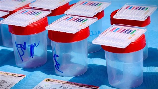 كشف تعاطي المخدرات