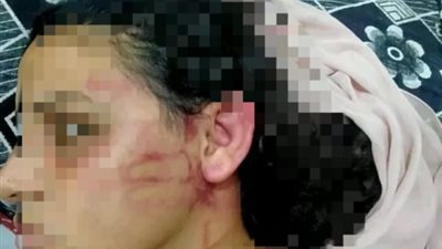 حاول شنقها.. زوج يعتدي على زوجته بالشرقية