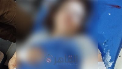30 غرزة وكسر بالذراع.. حبس الزوج المتهم بالاعتداء على زوجته بالمحلة 4 أيام على ذمة التحقيقات