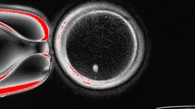 علماء ينجحون في تخليق بويضات بشرية سليمة من الجلد