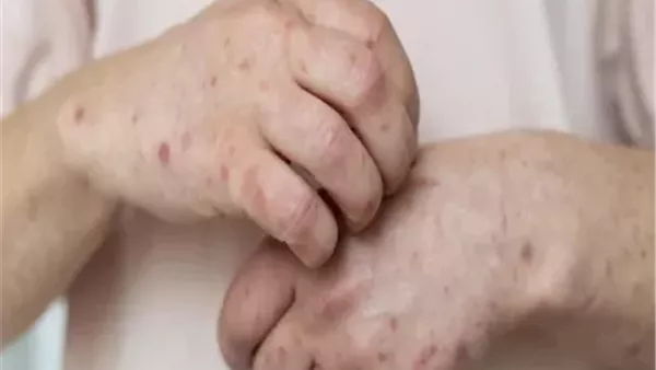 أسباب ظهور بقع حمراء