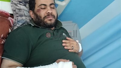 جابولي نزيف في المخ.. أول تعليق من محامي طالبات أكاديمية الضيافة بسوهاج بعد واقعة الاعتداء