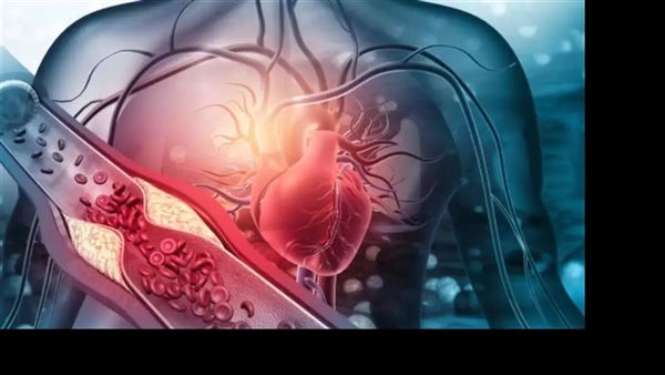  صورة تعبيرية 