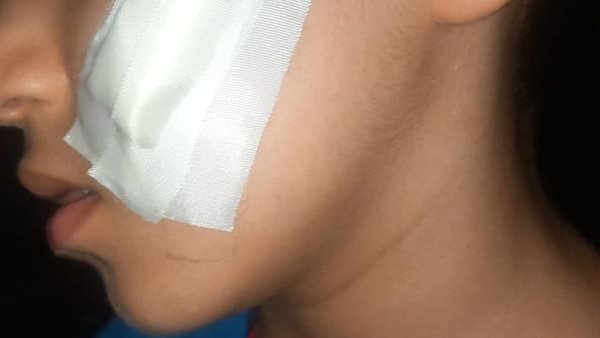 المجني عليه 