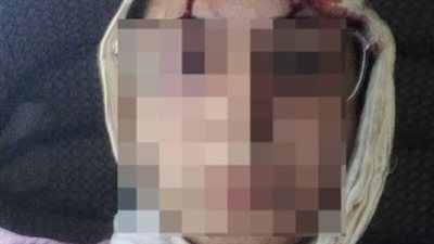 فتاة تروي تفاصيل مروّعة عن تعرضها للعنف الزوجي: تعرّضت للضرب والإهانة واتُهمت بالجنون