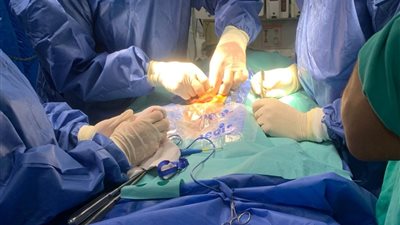 عملية معقدة.. إنقاذ طفلة عمرها 18 يومًا بعد جراحة نادرة بالأمعاء في مستشفى زاوية الناعورة بالمنوفية